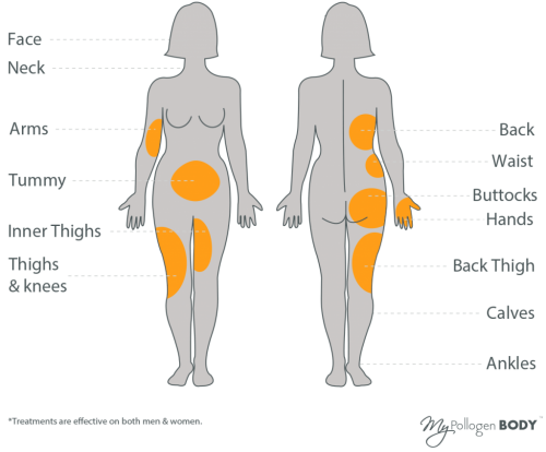 LipofirmPro-treatment-areas
